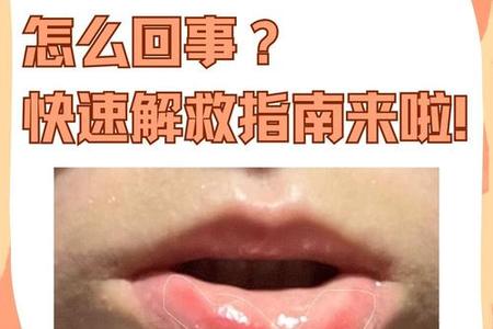 嘴巴2025年05月29日这个位置是好是坏