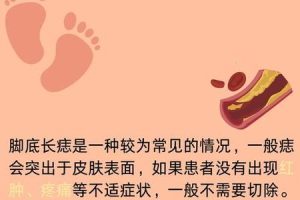脚底长痣2025年06月03日看你的财富运