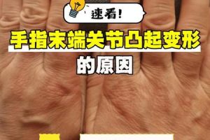 手指长短2025年06月04日这个位置是好是坏