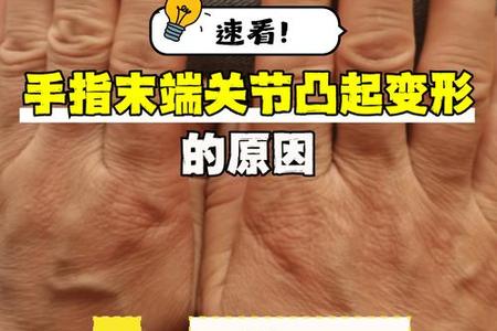 手指长短2025年06月04日这个位置是好是坏