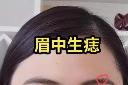 眉毛长痣2025年06月03日看你的财富运